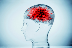 Brain cancer
