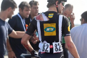 MTN fine injury problems